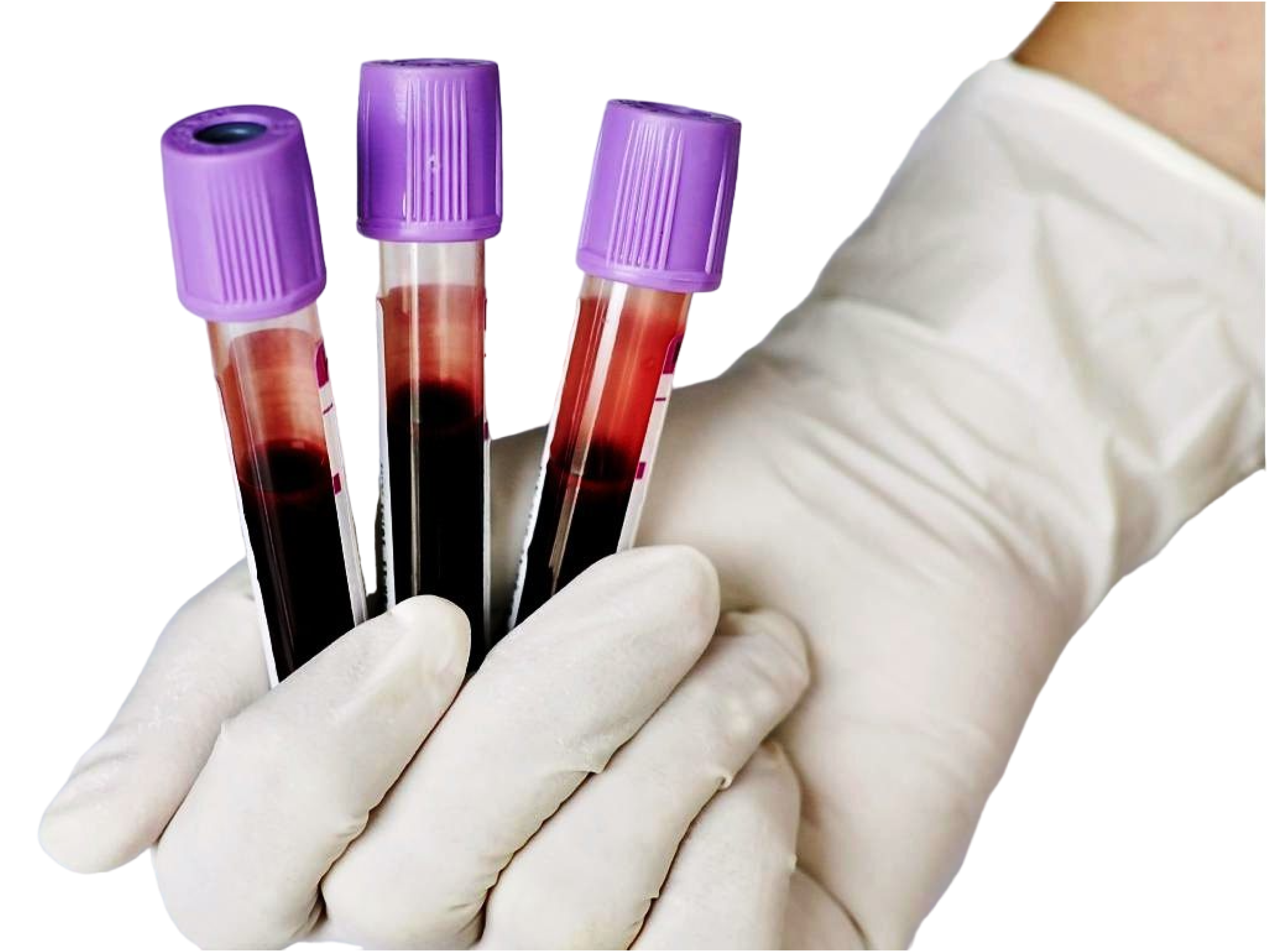 Анализы биологических жидкостей. Пробирка для исследования ОАК. Пробирки с кровью. Взятие крови на исследование в пробирку. Забор биоматериала для исследования.
